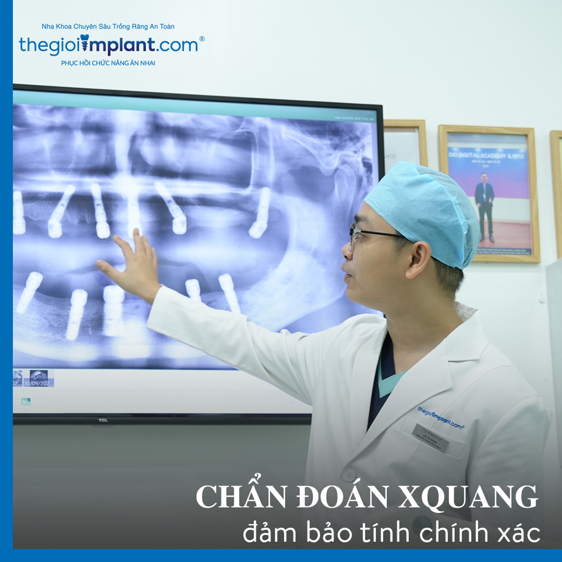 A patient after receiving dental implants