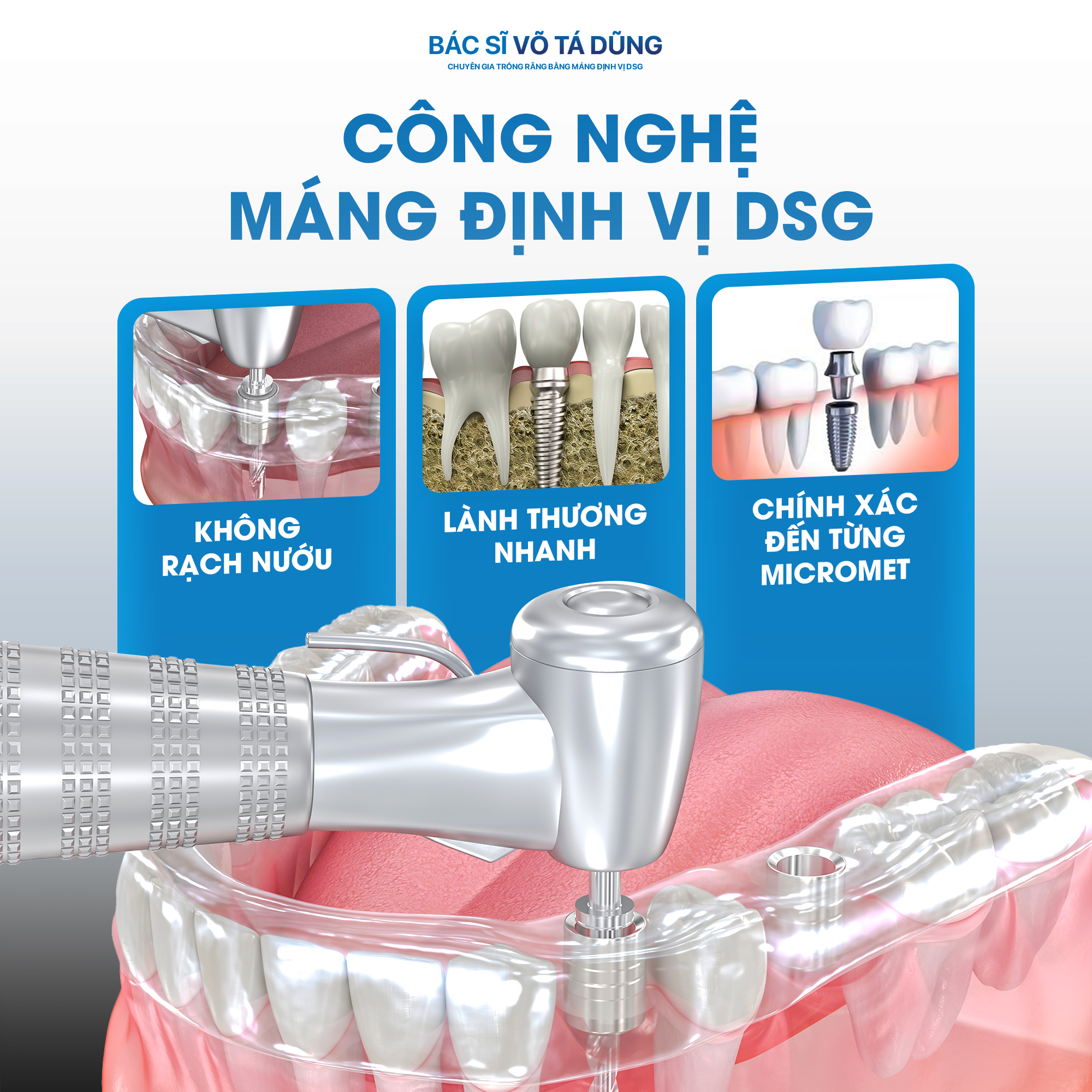 DSG Surgical Guide Technology - suture-free, faster recovery, high precision