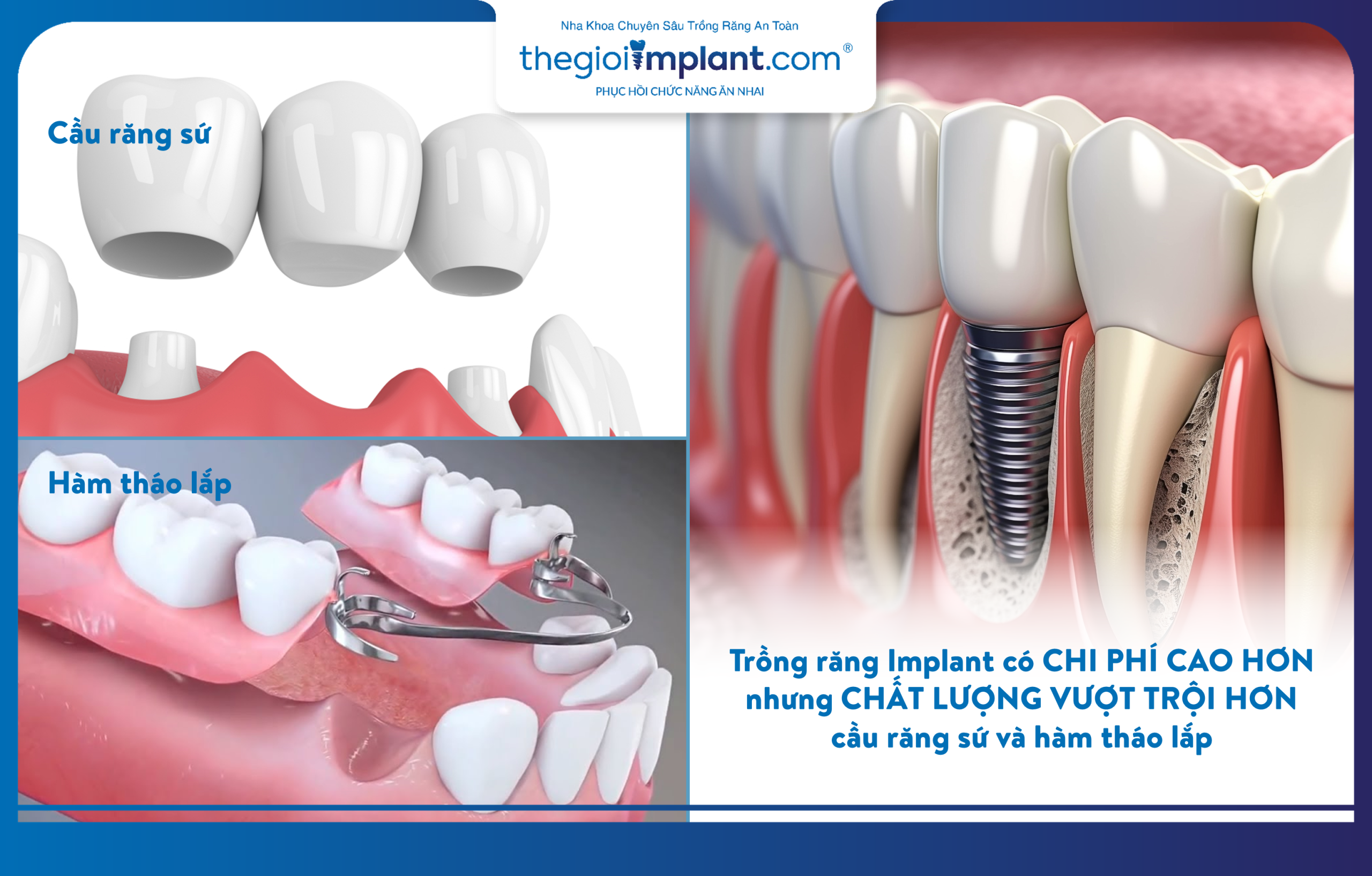 Dental implants have a higher initial cost but offer superior quality compared to other methods
