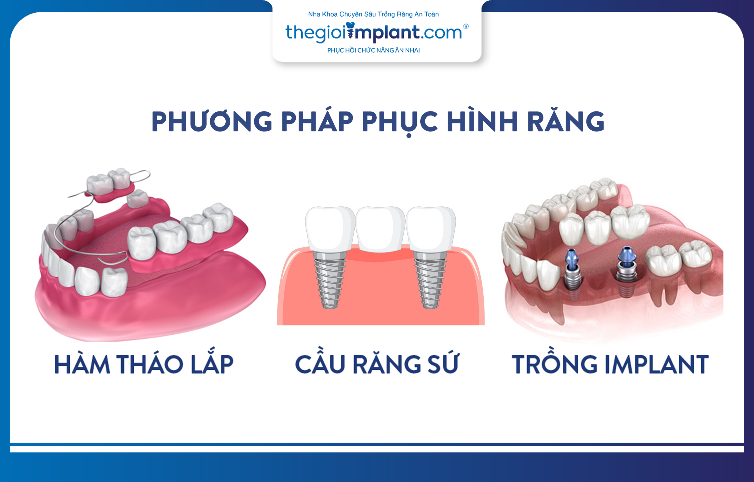 Common teeth restoration methods