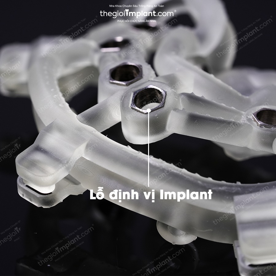 DSG Surgical Guide