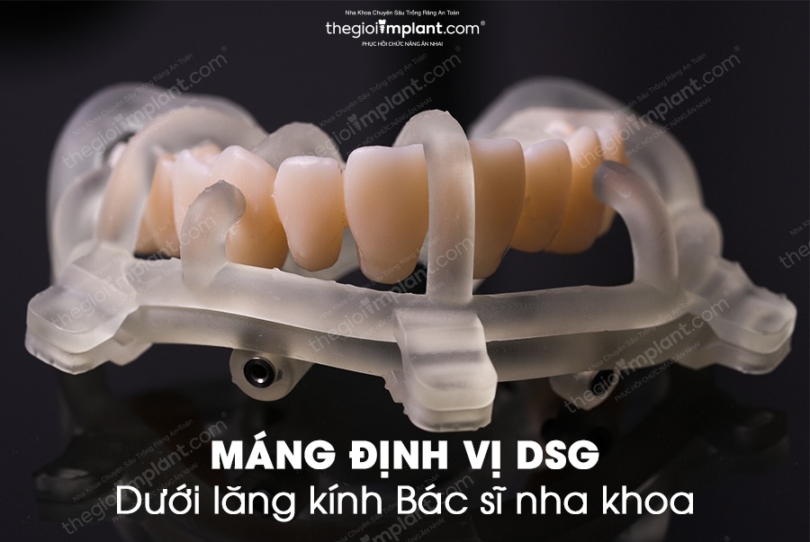 New teeth in 6 hours