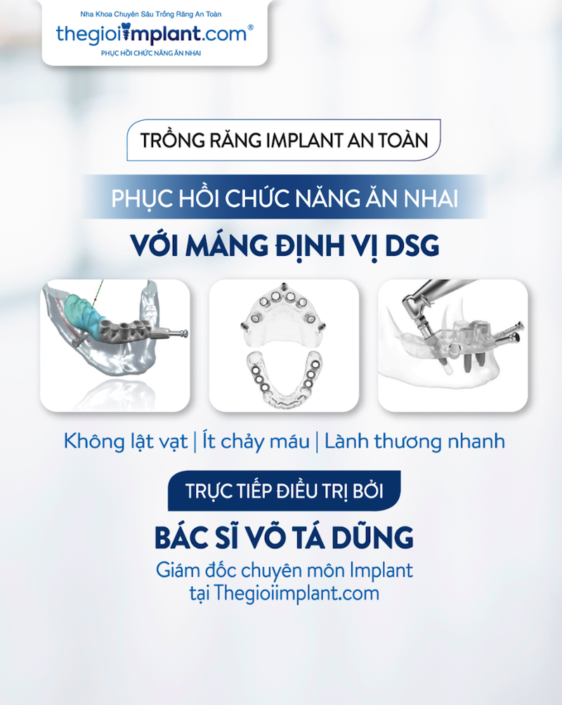 DSG Surgical Guide. A modern international standard for dental implants at Theimplantworld.com