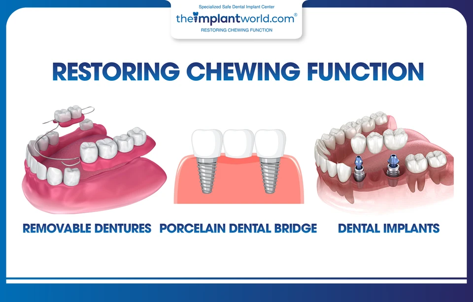 Common teeth restoration methods
