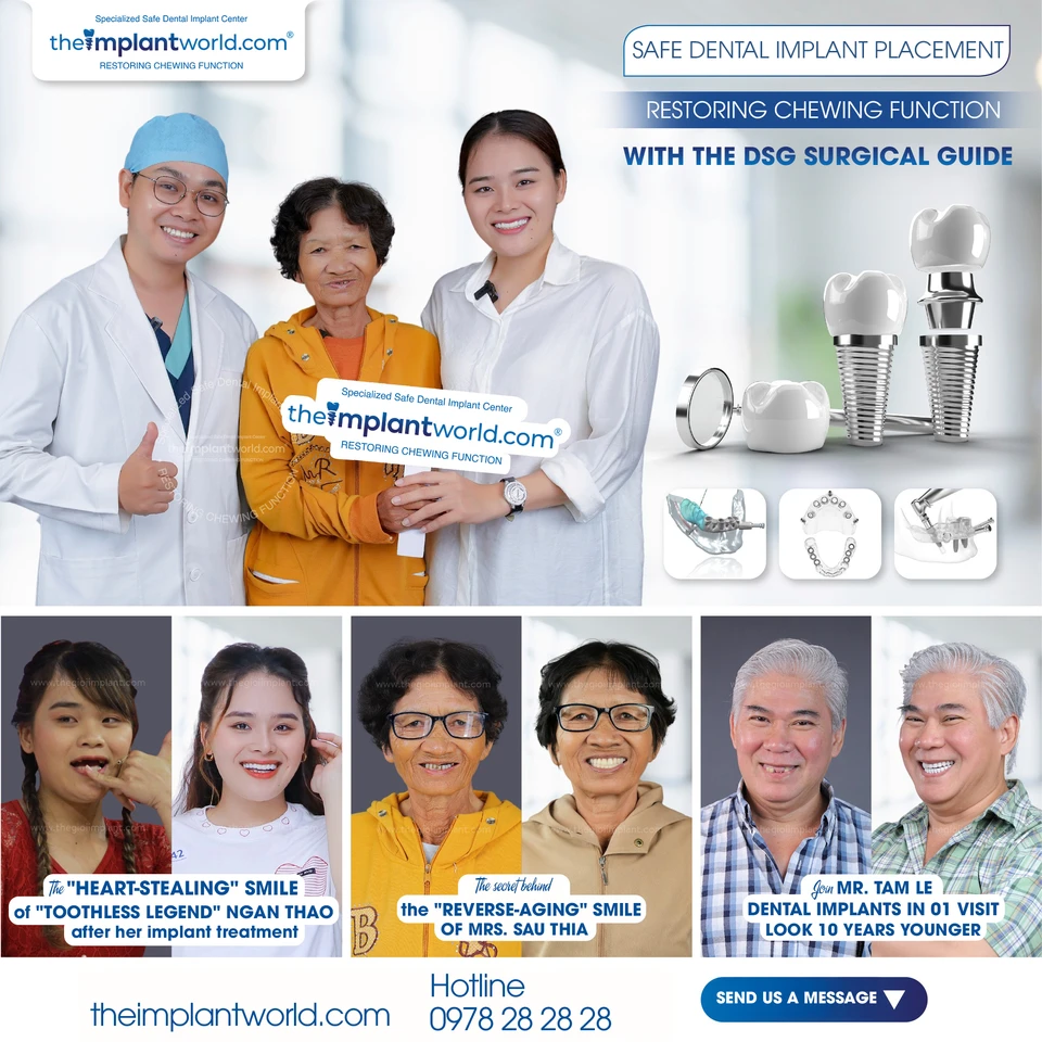 Complex implant case at Theimplantworld.com