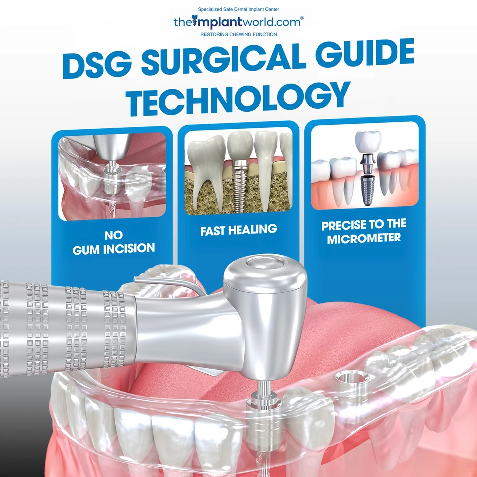 DSG Surgical Guide Technology - suture-free, faster recovery, high precision