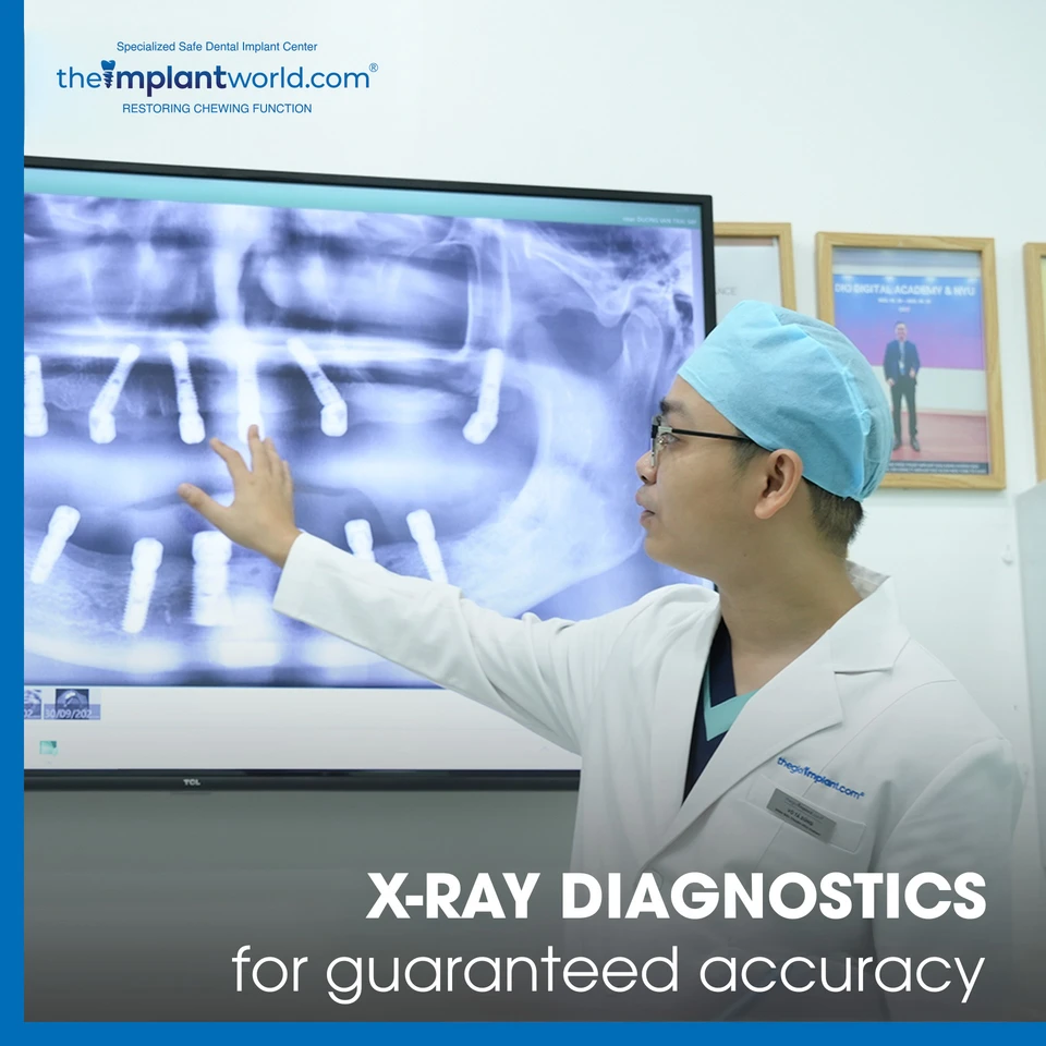 A patient after receiving dental implants